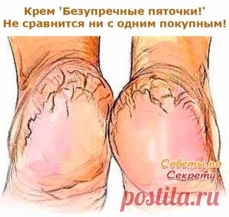 Крем 'Безупречные пяточки!'...не сравнится ни с одним покупным! Поделюсь с вами рецептом крема для пяток, который не сравнится ни с одним покупным средством. И самое главное - сделать его легко и быстро. Нужно только купить в аптеке тюбик мази календулы (20г) и ампулку жидкого витамина А (10 мл), так будет легче дозировать, поскольку соотношение должно быть 1:2. В небольшой емкости хорошенько перемешайте витамин А и мазь. Вот собственно и все. Затем переложите готовый крем...
