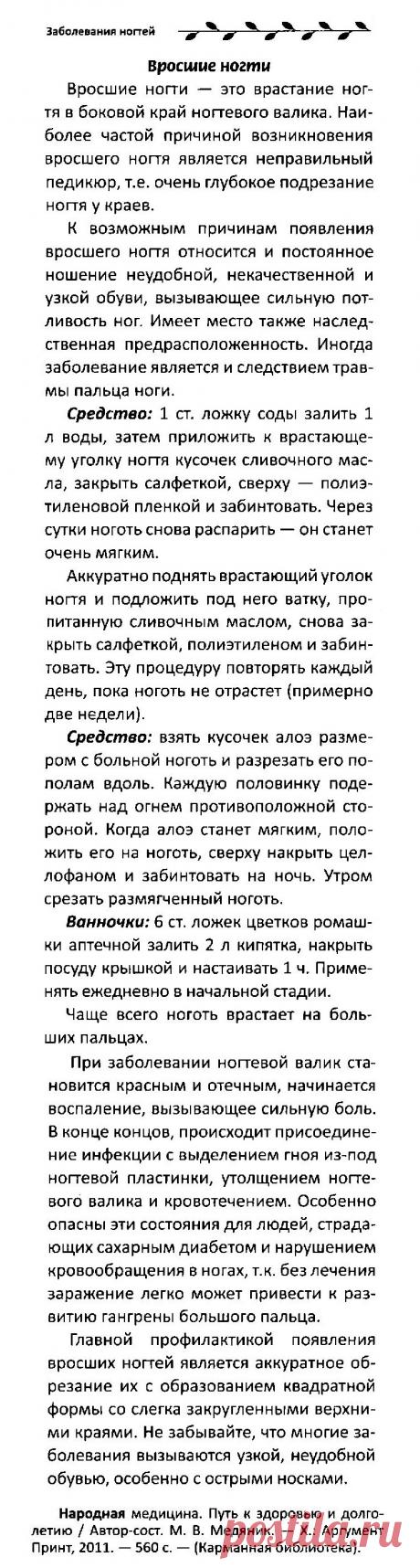 Вросшие ногти