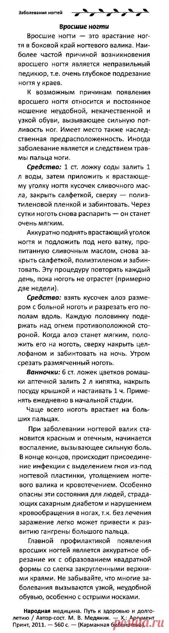 Вросшие ногти