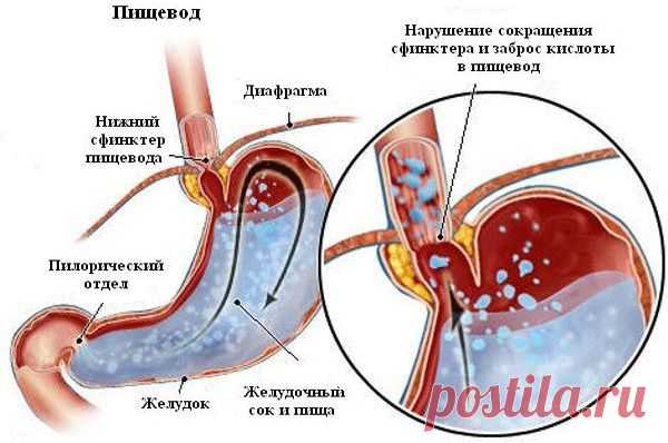 Чувство тошноты: причины и виды. Когда обращаться за помощью