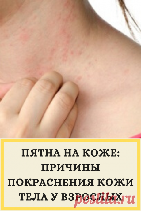 Пятна на коже: причины покраснения кожи тела у взрослых