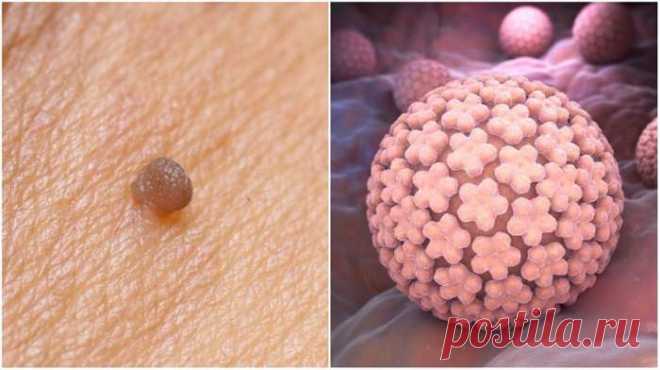 В борьбе с коварным врагом хороши любые методы. Действенные лекарства с полей и огородов! — Домашний уют