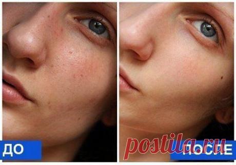 ГЛУБОКАЯ ЧИСТКА ЛИЦА ЗА 1 ПРОЦЕДУРУ
Из домашних продуктов!

Такую маску попробовали все мои подруги, в том числе и я! Мы в восторге, рекомендуем и вам:)

Нам нужно:
1. Мёд ( 0,5 ч. л.)
2. Пару капель.. Продолжение тут: ok.ru/bebeuty
Салон Красоты : Группа по интересам. Красота и здоровье : Одноклассники
Для самых красивых и самых мудрых!