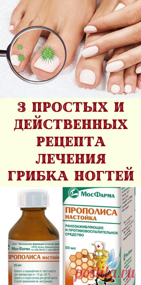 3 простых и действенных рецепта лечения грибка ногтей