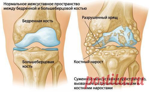 Народная медицина: Ревматизм, артрит, с / Популярная медицина