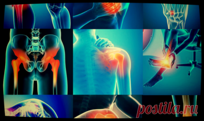 Почему болят суставы: одна еда восстанавливает, а другая усиливает боль и разрушает | Будь здоров | Яндекс Дзен