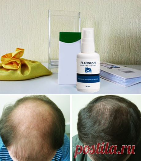 Блог Владимира Филяева. Как я восстановил волосы за 1 месяц