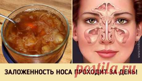 Средство от заложенного носа  

Осенне-зимний период — самое время простудных заболеваний. Даже если у вас отличный иммунитет, от этого недуга никто не застрахован. Особенно, если вы много работаете с людьми и ездите в общественн…