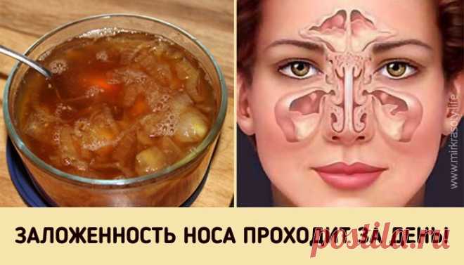 Средство от заложенного носа  

Осенне-зимний период — самое время простудных заболеваний. Даже если у вас отличный иммунитет, от этого недуга никто не застрахован. Особенно, если вы много работаете с людьми и ездите в общественн…
