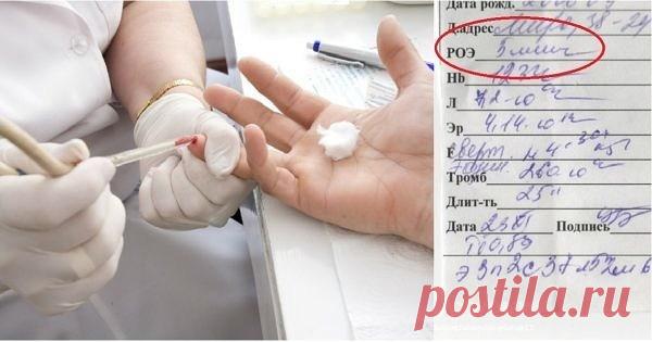 9 показателей крови, которые расскажут всё о здоровье: читай анализ правильно Сдавать кровь на анализ не единожды приходилось каждому человеку. Это один из важных методов лабораторного исследования, назначаемый при большинстве заболеваний, ведь изменения в составе крови отражаю…