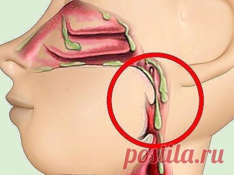 1.   СЛИЗЬ В ОРГАНИЗМЕ.  ОТКУДА БЕРЁТСЯ, ЧЕМ ОПАСНА И КАК ВЫВОДИТЬ.
2.  КАК ИЗБАВИТЬСЯ ОТ ПАПИЛЛОМ?
3.  Выполняйте эти упражнения в течении двух недель   
и вы заметите, как исчезает ваш животик.   
4.  ДИАБЕТ: 8 ПРОДУКТОВ, КОТОРЫЕ СНИЖАЮТ САХАР В КРОВИ.
5.  10 полезных упражнений для суставов, не вставая с постели.
6.  Признаки инсульта.
7.  ЛЕЧЕНИЕ АЛЮМИНИЕВОЙ ФОЛЬГОЙ.
8.  Как Помочь Больным Суставам.
9.   ПОХУДЕЙ  ЗА  30  ДНЕЙ.
10..  Как пережить сердечный приступ, если...