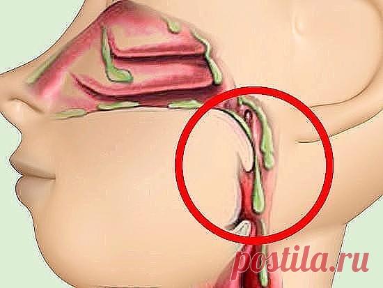 1.   СЛИЗЬ В ОРГАНИЗМЕ.  ОТКУДА БЕРЁТСЯ, ЧЕМ ОПАСНА И КАК ВЫВОДИТЬ.
2.  КАК ИЗБАВИТЬСЯ ОТ ПАПИЛЛОМ?
3.  Выполняйте эти упражнения в течении двух недель   
и вы заметите, как исчезает ваш животик.   
4.  ДИАБЕТ: 8 ПРОДУКТОВ, КОТОРЫЕ СНИЖАЮТ САХАР В КРОВИ.
5.  10 полезных упражнений для суставов, не вставая с постели.
6.  Признаки инсульта.
7.  ЛЕЧЕНИЕ АЛЮМИНИЕВОЙ ФОЛЬГОЙ.
8.  Как Помочь Больным Суставам.
9.   ПОХУДЕЙ  ЗА  30  ДНЕЙ.
10..  Как пережить сердечный приступ, если...