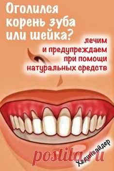 Такое явление никак нельзя оставлять без внимания. С ситуацией сталкивается большинство людей, и все, что им нужно знать – это то, что незамедлительное лечение крайне необходимо. Рассмотрим несколько проверенных методов, которые гарантируют результат. #шейказуба #оголилсязуб #зубы #хединсайдер