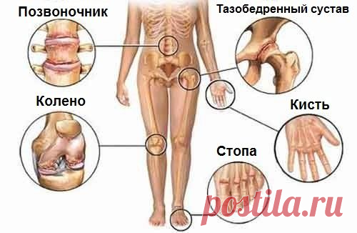Попрощайся с болью в суставах! 5 полезных советов - Искусство здоровой жизни