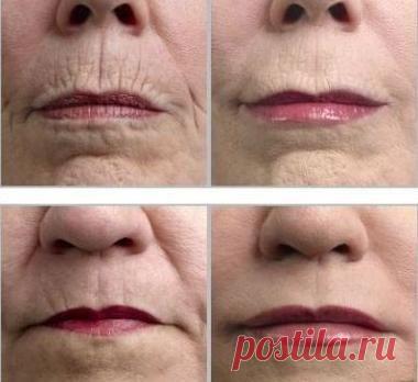 Homemade Wrinkle Removers That Work | MediMiss