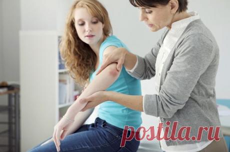 Псориаза жұқпалы ма?
Көптеген адамдар, псориазбен ауыратын адамның көз алдында, науқаспен байланыс арқылы өтпейтініне қарамастан, осы ауруды жасырудан қорыққандықтан, онымен байланысқа түспеуі керек: қолды ұстамау арқылы, тимеу, құшу және т.б. Псориаз айыруға) - инфекция емес.
Псориаз күнделікті байланыста ма? | Мәңгілік мәселелер