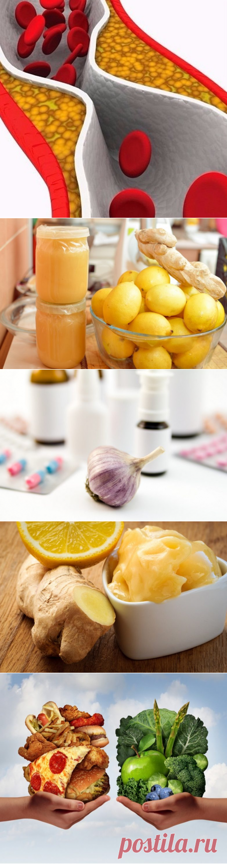 Для тех кому за 30, чистка сосудов — 
ИНГРЕДИЕНТЫ
1 измельченный зубчик чеснока
1 ст. л. свежего лимонного сока
1 тертый корень имбиря
1 ст. л. яблочного уксуса
1 ч. л. мёда
Смешай ингредиенты в миске и хорошо их перемешай.Если получилось больше лекарства, чем нужно — держи его в холодильнике до 5 дней, но не более.Употребляй эту смесь перед завтраком и обедом, но не более чем в три раза в день. Это домашнее средство поможет снизить уровень холестерина и нормализовать кровяное давление.