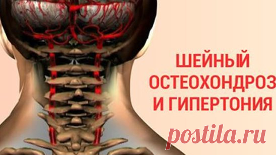 Мало кто поверит в тот факт, что шейный остеохондроз может быть намного опаснее онкологических заболеваний. Но тем не менее это так! Многочисленные пациенты врача-реабилитолога Александра Шишонина утверждают, что лучше правильно крутить шеей, чем всю жизнь страдать от гипертонии и бояться внезапного наступления инфаркта или инсульта.
Упражнения при шейном остеохондрозе
Шишонин убежден, что именно шейный остеохондроз становится первопричиной гипертонии, и лишь в 5 % случаев...
