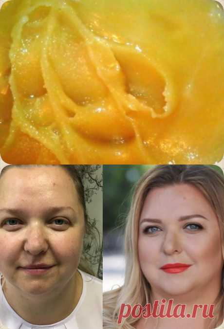 Я пользовалась этой мазью 2 недели… Теперь не верю своим глазам! Кожа преобразилась! - interesno.win