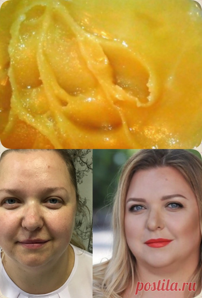 Я пользовалась этой мазью 2 недели… Теперь не верю своим глазам! Кожа преобразилась! - interesno.win