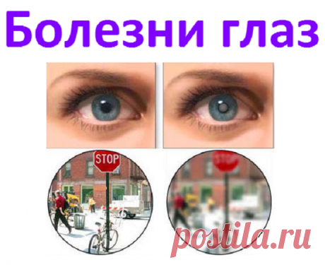 Болезни глаз и лечение их народными способами | Советы целительницы