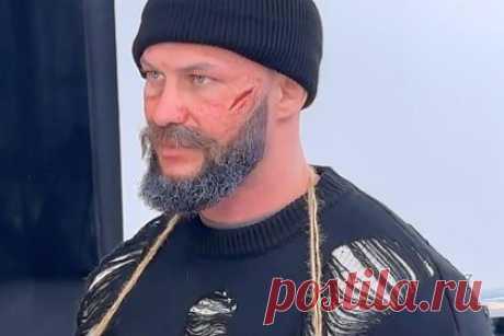 Оксана Самойлова показала Джигана в костюме бомжа. Блогерша и предпринимательница Оксана Самойлова показала своего мужа рэпера Джигана в костюме бомжа. Так, музыкант предстал перед камерой в образе бездомного. Он примерил рваный черный свитер и мешковатые штаны, а на его лицо нанесли специальный грим. В результате на коже рэпера оказались царапины, а борода поседела.