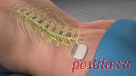 The global spinal devices market size was valued at USD 11.59 Billion in 2018 and is projected to reach USD 15.74 Billion by 2026, exhibiting a CAGR of 3.9% during the forecast period.