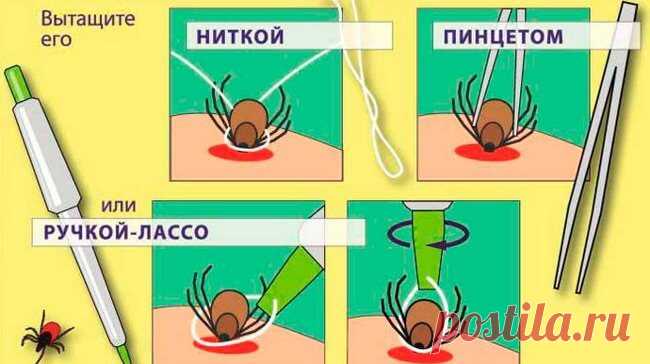 Укусы насекомых: 12 видов и что делать при каждом из них