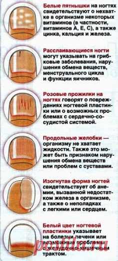 ДИАГНОСТИКА ПО НОГТЯМ РУК