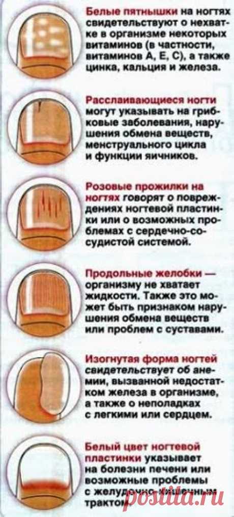 ДИАГНОСТИКА ПО НОГТЯМ РУК