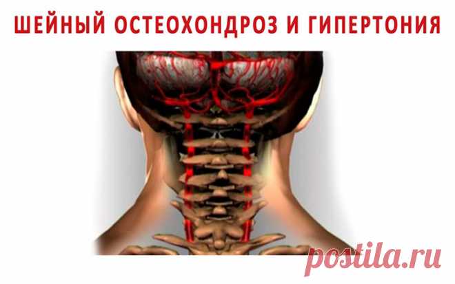 Сегодня собственная шея убивает втрое больше людей, чем онкология Лучше правильно крутить шеей, чем пить горстями таблетки от давления и жить в постоянном страхе инфаркта и инсульта!
