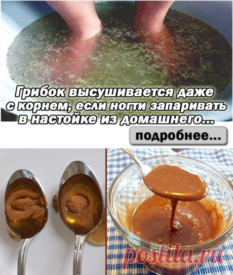 Даже врачи поражаются эффекту от этого средства: оно предотвращает……… — Полезные советы