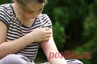 Как убрать укус комара за 20 секунд ПОЛНОСТЬЮ и главное - ничего не надо покупать, носить с собой!