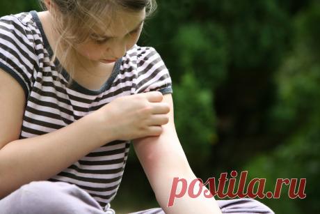 Как убрать укус комара за 20 секунд ПОЛНОСТЬЮ и главное - ничего не надо покупать, носить с собой!