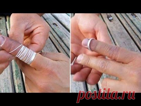 Как снять "неснимаемое" кольцо с пальца - Советы на каждый день