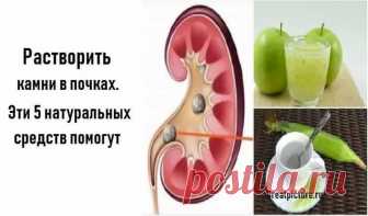 Растворить камни в почках. Эти 5 натуральных средств помогут Растворить камни в почках. Эти 5 натуральных средств помогут.Камни в почках могут вызывать сильную боль и травмировать мочевыводящие пути.Растворить камни в почках. Рекомендуем вам эти 5 натуральных средств, чтобы растворить их...