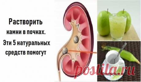 Растворить камни в почках. Эти 5 натуральных средств помогут Растворить камни в почках. Эти 5 натуральных средств помогут.Камни в почках могут вызывать сильную боль и травмировать мочевыводящие пути.Растворить камни в почках. Рекомендуем вам эти 5 натуральных средств, чтобы растворить их...