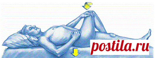 Лечение синдрома грушевидной мышцы. Упражнения, ЛФК.