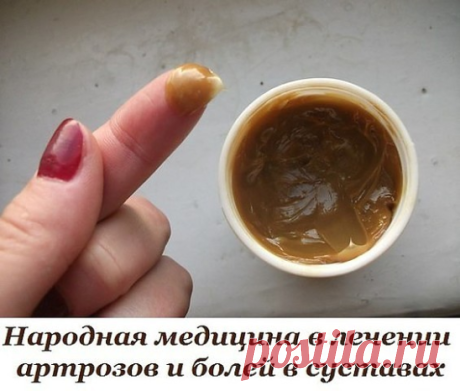 КАК ВЫЛЕЧИТЬ КОЛЕНИ

Предлагаю свой рецепт:как я вылечила колени. Они у меня опухали,не гнулись,особенно под гору было ходить трудно,при ходьбе резкая боль. А лечила я их так. 

Взяла всё в равных частях 1:1:1: свиную желчь.глицерин,йод,спирт нашатырный. Перемешала,хорошо взболтала. Намочила тряпку,сверху поиэтилен и обмотала тёплым шарфом. Грело,потом жгло,терпела сколько могла,потом убирала,появилась краснота,но ожога не было. А после 4-х процедур всё прошло. Делала на н...