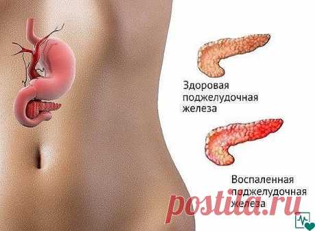 ЕСЛИ БЕСПОКОИТ ПОДЖЕЛУДОЧНАЯ ЖЕЛЕЗА 
Есть способ не только облегчить страдания, но и навсегда забыть о этой напасти..... Это семя льна..., оно единственное! способно вылечить вашу поджелудочную железу. 
 
Нужно: 
 
Свежемолотую столовую ложку семян льна заварить 0,5 стакана кипятка.... 
Дать потомиться на слабом огне 5 минут при закрытой крышке и оставить остывать в таком состоянии..... а тёпленьким, как остынет - выпить этот киселек вместе со всеми шелушками от семени за ...