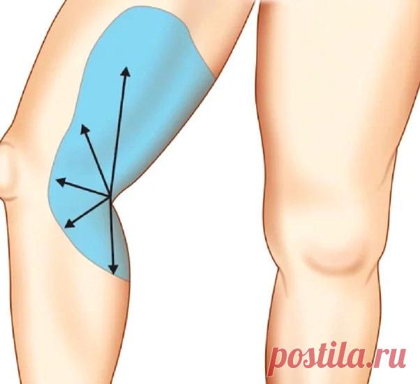 КАК ПОХУДЕТЬ В НОГАХ: делайте это 3 минуты перед сном! Короткий комплекс, который придумала знаменитый американский тренер звезд Трейси Андерсон, позволяет убрать так называемые «жировые ловушки» на коленях и бедрах, которые есть даже у стройных людей.