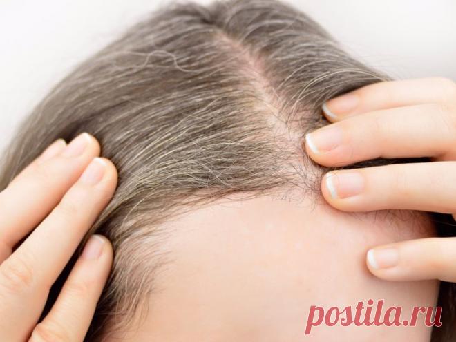 Белые волосы чернеют за неделю с картофельной кожурой  - Полезные советы красоты