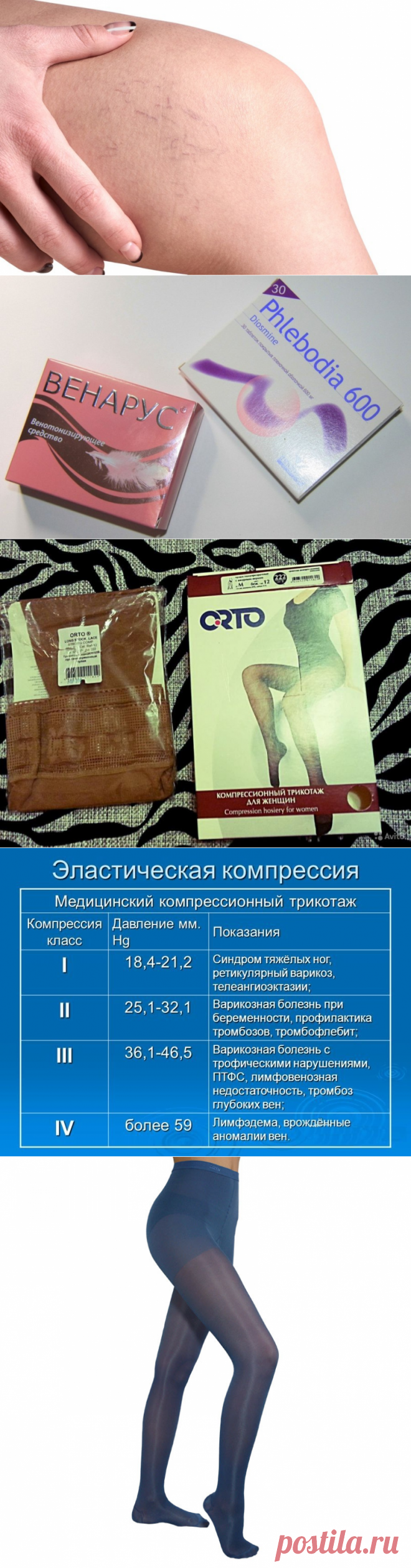 Компрессионный трикотаж Orto - преимущества и противопоказания к применению