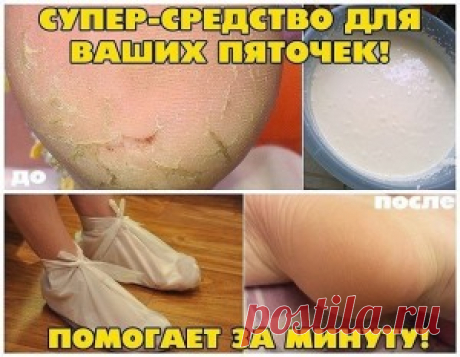 Домашнее СРЕДСТВО ДЛЯ ВАШИХ ПЯТОЧЕК
