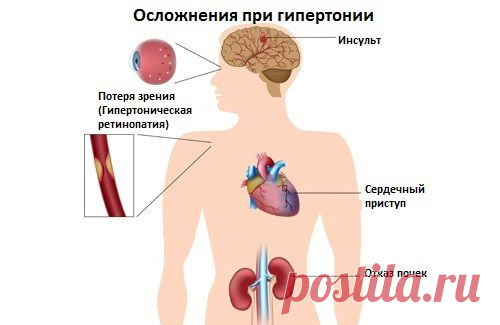 Лучшие продукты для борьбы с высоким давлением - Шаг к Здоровью