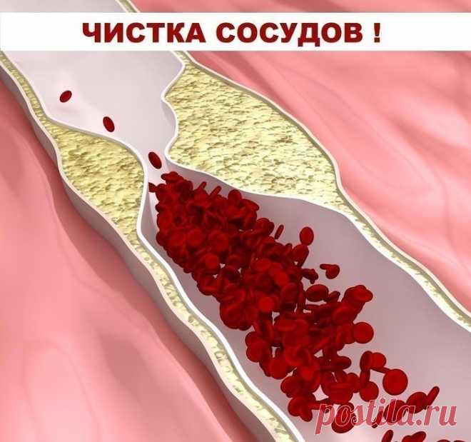 КАК ПОНИЗИТЬ ХОЛЕСТЕРИН?
