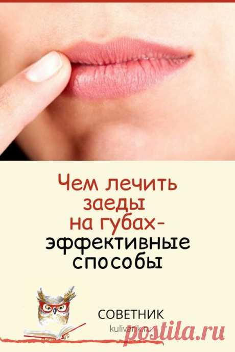 Чем лечить заеды на губах: эффективные способы