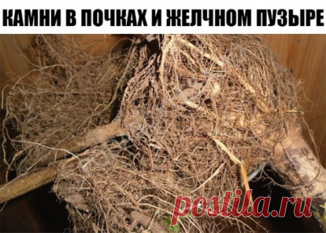 Камни в желчном пузыре,в почках. 
Хочу поделиться некоторыми рецептами, которые я испытал на себе в борьбе за свое здоровье. 
Лет пять назад меня увезли на «скорой» в больницу с приступом колик в печени. При обследовании выяснилось, что в желчном пузыре три камня: 1,2 см, 1 см и 0,8 см. Хотели резать, но я отказался и стал лечиться домашними способами. 
Вначале пил урину по 3-5 глотков 3 раза в день. Затем узнал рецепт с корнем подсолнуха и стал пить его настой. Проверился на УЗИ — камней нет