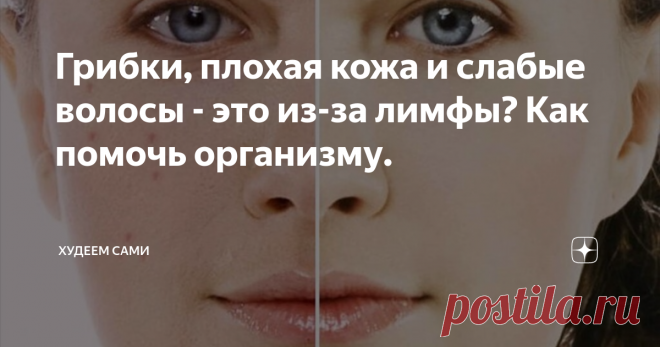 Грибки, плохая кожа и слабые волосы - это из-за лимфы? Как помочь организму.  Ты редко думаешь о лимфе, но она думает о тебе постоянно. Написанное ниже познакомит вас друг с другом поближе.