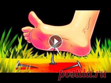 Что будет, если ржавый гвоздь воткнется вам в ногу? Что случится, если наступить на ржавый гвоздь? Возбудителем столбняка является столбнячная палочка, которая встречается в почве, грязи и фекалиях живо...